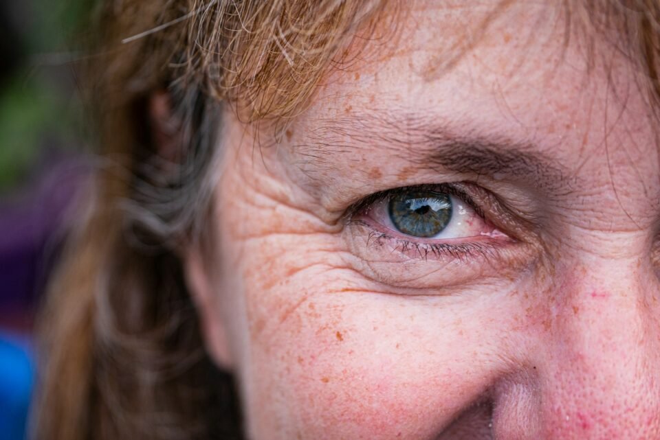 Reduce Your Unwanted Wrinkles